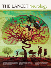Lancet neurology pubblica a giugno il lavoro &ldquo;Imaging biomarkers of vulnerable carotid plaques for stroke risk prediction and their potential clinical implications&rdquo;