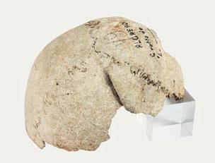 Cranio incompleto di Lu Maccioni con lesione traumatica