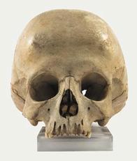 Cranio serie Recupero, patologico