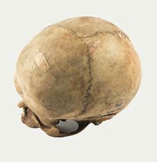 Cranio brachimorfo