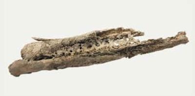 Reperti scheletrici, Tibia e fibula patologici
