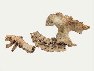 Reperti scheletrici, Colonna vertebrale patologica
