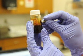 Clorochina, efficace in vitro contro una vasta gamma di virus
