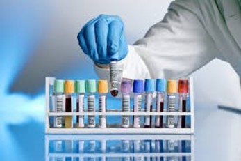 Test sierologici per la ricerca di anticorpi