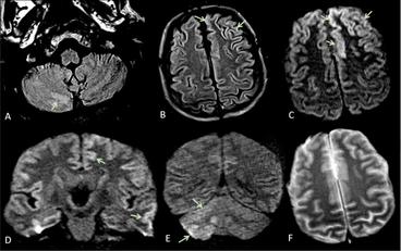 I riferimenti ineludibili dai risultati di neuroimaging
