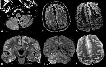 Il cervello dell'uomo, tra ricerca e angoli ancora oscuri. La foto si riferisce a immagini radiografiche del team di Luca Saba, attuale presidente della facolt&agrave; di Medicina e chirurgia