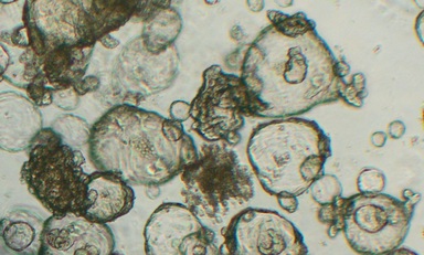 Un particolare degli studi sugli organoidi