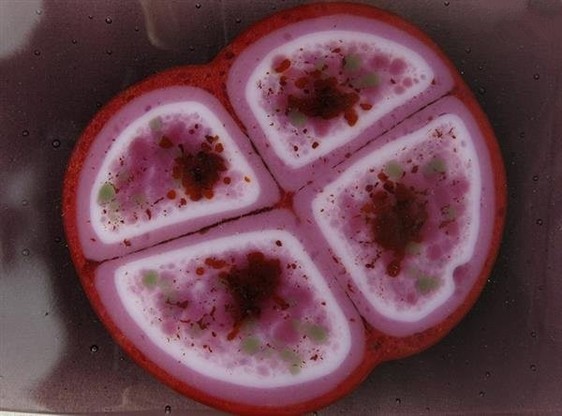 il batterio Deinococcus radiodurans visto al microscopio